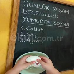 Günlük Yaşam Becerileri: Yumurta Soyma! 🥚✨